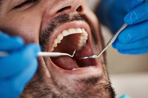 Best Emergency Dental Care for Trauma or Injury in Eddyville, IA